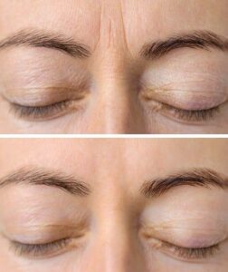 Best Serum for Fine Lines and Wrinkles Oh-Snap-Line-Easing-Instant-Deep-Wrinkle-Relaxer