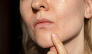 best serum for dry skin rough skin